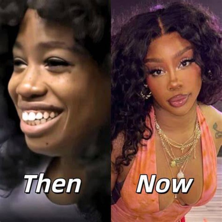 Fans Believe Sza Had Plastic Surgery, Reveal Photos Of Sza Before
