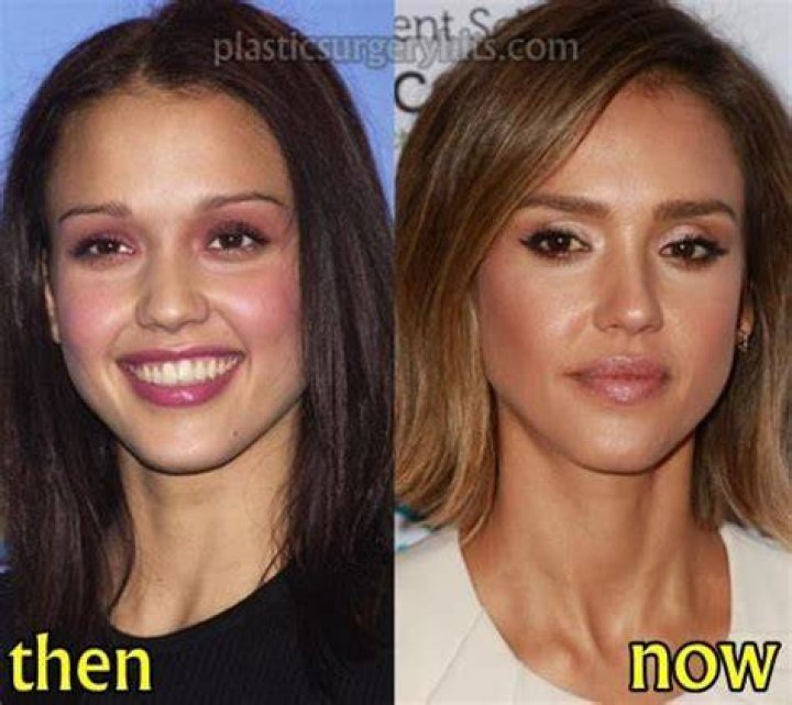 Jessica Alba Plastic Surgery or Is She Blessed by Nature?