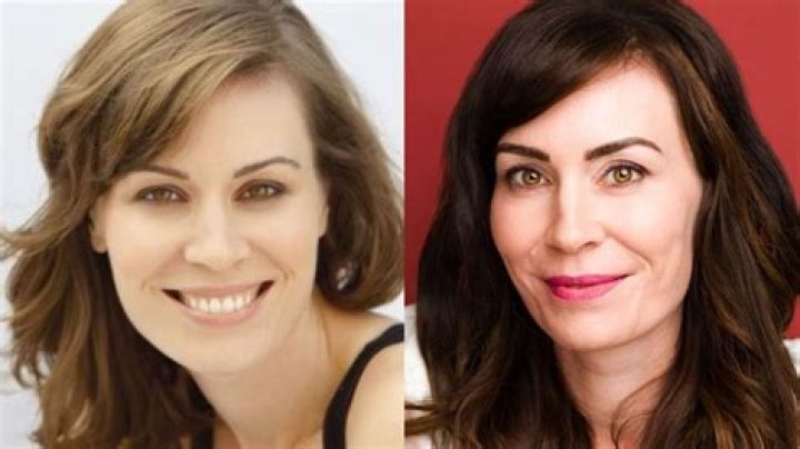Toyota Jan's Plastic Surgery Journey
